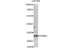 Western blot analysis of extracts of U-87MG cells, using GPM6A antibody (ABIN5995821) at 1/1000 dilution. (GPM6A antibody)