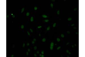 Immunofluorescence staining of Hela Cells with ABIN7127776 at 1:50, counter-stained with DAPI. (Recombinant Caspase 3 antibody)