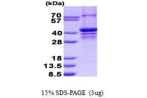 PARP2 Protein (His tag)