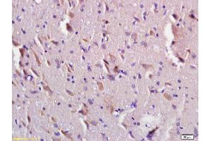 Formalin-fixed and paraffin embedded rat brain labeled with Anti-TMEM2L/KIAA1199 Polyclonal Antibody, Unconjugated (ABIN872432) at 1:200 followed by conjugation to the secondary antibody and DAB staining. (CEMIP antibody  (AA 101-200))