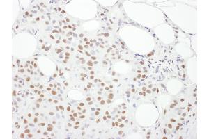 Immunohistochemistry (IHC) image for anti-Protein Kinase, DNA-Activated, Catalytic Polypeptide (PRKDC) (AA 4078-4128) antibody (ABIN7453431)
