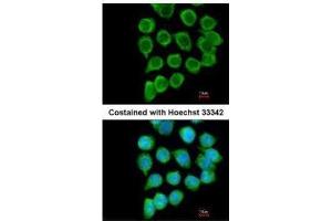 ICC/IF Image Immunofluorescence analysis of methanol-fixed A431, using RELT, antibody at 1:200 dilution. (RELT antibody  (Center))