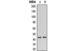 Western blot analysis of GATA1 (pS310) expression in HeLa (A), HEK293T (B) whole cell lysates. (GATA1 antibody  (C-Term, pSer310))