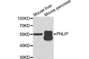 Western blot analysis of extracts of various cell lines, using PNLIP antibody (ABIN5973798) at 1/1000 dilution.