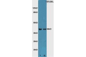 Lane 1:Mouse embryo lysate Lane 2:Mouse eye lysate probed with Rabbit Anti-ATF4/CREB-2 Polyclonal Antibody, Unconjugated  at 1:5000 for 90 min at 37˚C. (ATF4 antibody  (AA 251-351))