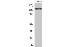 Western Blotting (WB) image for anti-Suppression of Tumorigenicity 5 (ST5) (Internal Region) antibody (ABIN3177531) (ST5 antibody  (Internal Region))