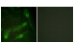 Immunofluorescence analysis of HeLa cells, using Smad2 (Phospho-Thr220) antibody. (SMAD2 antibody  (pThr220))