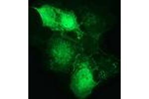 Immunofluorescence (IF) image for anti-Catenin (Cadherin-Associated Protein), beta 1, 88kDa (CTNNB1) antibody (ABIN1496892) (CTNNB1 antibody)