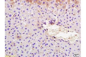 Formalin-fixed and paraffin embedded mouse liver labeled with Rabbit Anti SYVN1/HRD1 Polyclonal Antibody, Unconjugated (ABIN671811) at 1:200 followed by conjugation to the secondary antibody and DAB staining