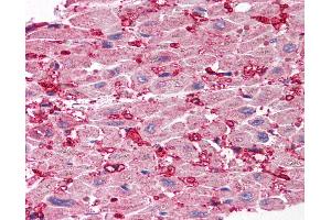 Anti-SCO1 antibody IHC of human heart. (SCO1 antibody  (Internal Region))