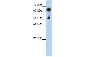 WB Suggested Anti-HSPA6 Antibody Titration: 0. (HSPA6 antibody  (Middle Region))