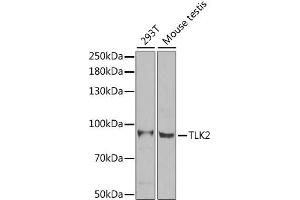 Western blot analysis of extracts of various cell lines, using TLK2 antibody.
