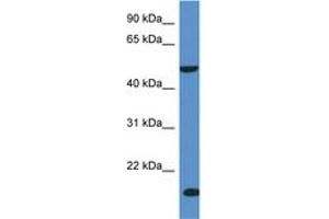 Image no. 1 for anti-Inositol Polyphosphate-5-Phosphatase K (INPP5K) (AA 244-293) antibody (ABIN6746948) (INPP5K antibody  (AA 244-293))
