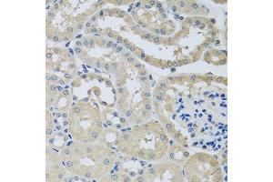 Immunohistochemistry of paraffin-embedded mouse kidney using CHMP1B antibody.