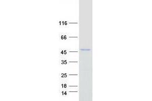 Validation with Western Blot