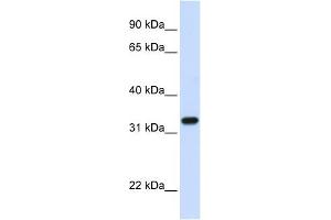 TBCB antibody used at 1 ug/ml to detect target protein. (TBCB antibody  (C-Term))