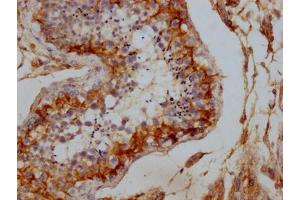 IHC image of ABIN7150076 diluted at 1:100 and staining in paraffin-embedded human testis tissue performed on a Leica BondTM system. (DLG4 antibody  (AA 551-724))