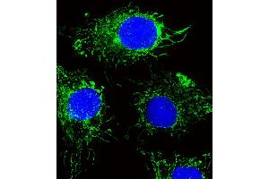 Fluorescent image of HepG2 cells stained with NDUFC2 Antibody . (NDUFC2 antibody  (N-Term))