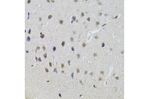 Immunohistochemistry of paraffin-embedded mouse brain using STAT1 antibody (ABIN5969976) at dilution of 1/100 (40x lens). (STAT1 antibody)