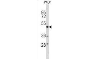 Western Blotting (WB) image for anti-DEK Oncogene (DEK) antibody (ABIN3004071)