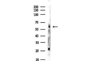 anti-Cytochrome P450, Family 26, Subfamily C, Polypeptide 1 (CYP26C1) (Internal Region) antibody