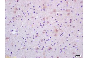 Formalin-fixed and paraffin embedded rat brain labeled with Rabbit Anti CDC37 Polyclonal Antibody, Unconjugated (ABIN706481) at 1:200 followed by conjugation to the secondary antibody and DAB staining (CDC37 antibody  (AA 291-378))