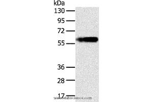 Western blot analysis of Human fat tissue, using PLIN1 Polyclonal Antibody at dilution of 1:200 (PLIN1 antibody)