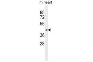 AP1M1 Antibody (Center) western blot analysis in mouse heart tissue lysates (35µg/lane). (AP1M1 antibody  (Middle Region))