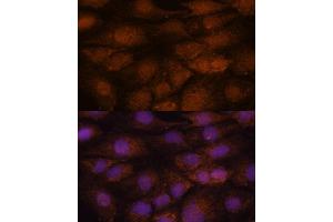 Immunofluorescence analysis of C6 cells using CEP85 antibody (ABIN7266281) at dilution of 1:100. (CEP85 antibody  (AA 130-430))