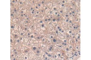 Used in DAB staining on fromalin fixed paraffin- embedded liver tissue (CD5 antibody  (AA 25-372))