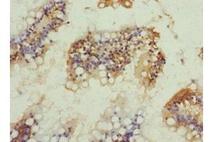 Immunohistochemistry of paraffin-embedded human small intestine tissue using ABIN7161238 at dilution of 1:100