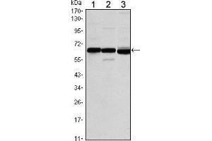 Western blot analysis using ESR1 mouse mAb against MCF-7 (1), T47D (2) and SKBR3 (3) cell lysate. (Estrogen Receptor alpha antibody)