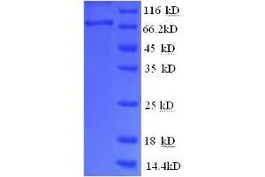 SDS-PAGE (SDS) image for Bruton Agammaglobulinemia tyrosine Kinase (BTK) (AA 2-659) protein (His tag) (ABIN5713290) (BTK Protein (AA 2-659) (His tag))