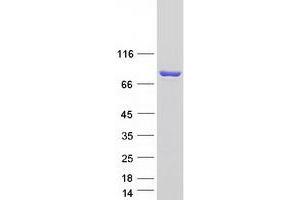 Validation with Western Blot (ENOX1 Protein (Transcript Variant 2) (Myc-DYKDDDDK Tag))