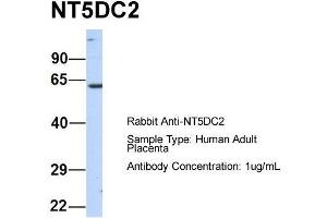 Host:  Rabbit  Target Name:  NT5DC2  Sample Type:  Human Adult Placenta  Antibody Dilution:  1. (NT5DC2 antibody  (N-Term))