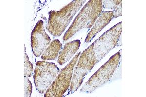Immunohistochemistry of paraffin-embedded rat testis using CD47 Rabbit pAb (ABIN3022623, ABIN3022624, ABIN3022625, ABIN1512716 and ABIN6218964) at dilution of 1:100 (40x lens). (CD47 antibody  (AA 20-140))