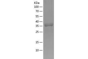 Western Blotting (WB) image for Caveolin 1, Caveolae Protein, 22kDa (CAV1) (AA 2-104) protein (His-IF2DI Tag) (ABIN7281974) (Caveolin-1 Protein (AA 2-104) (His-IF2DI Tag))