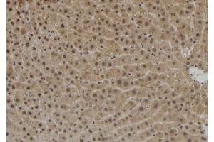 ABIN6272533 at 1/100 staining Rat liver tissue by IHC-P. (ZNF839 antibody  (Internal Region))