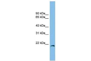 WB Suggested Anti-CIRBP Antibody Titration: 0. (CIRBP antibody  (Middle Region))