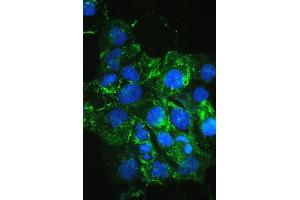 anti-Fms-Related Tyrosine Kinase 4 (FLT4) antibody