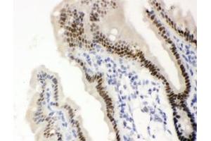 IHC testing of FFPE mouse intestine with SLC22A2 antibody. (Vitamin D Receptor antibody)