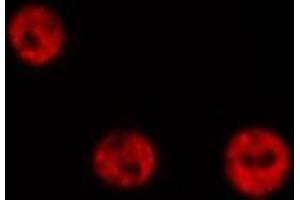 ABIN6267061 staining 293T  cells by IF/ICC. (NF-kB p65 antibody  (acLys310))