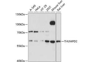 Western blot analysis of extracts of various cell lines, using THUMPD2 Antibody (ABIN6128828, ABIN6149131, ABIN6149132 and ABIN6215413) at 1:3000 dilution. (THUMPD2 antibody  (AA 404-503))
