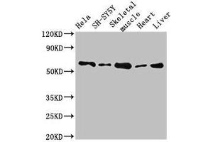 Western Blot Positive WB detected in: Hela whole cell lysate, SH-SY5Y whole cell lysate, Mouse skeletal muscle tissue, Rat heart tissue, Rat liver tissue All lanes: ASNS antibody at 2. (Asparagine Synthetase antibody  (AA 364-551))