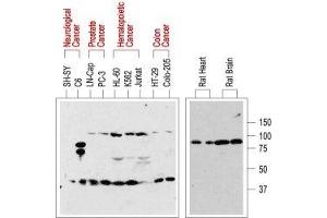Western blot analysis of normal rat tissue (right) and in human cancer cell lines (left): - p75NTR is visualized with Anti-p75 NGF Receptor (extracellular) Antibody (ABIN7043344, ABIN7044755 and ABIN7044756), (1:200). (NGFR antibody  (Extracellular, Stalk Region))