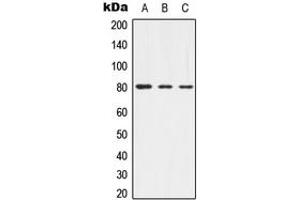 Western blot analysis of Alpha-adducin (pT445) expression in HEK293T (A), mouse brain (B), rat brain (C) whole cell lysates. (alpha Adducin antibody  (pSer445))