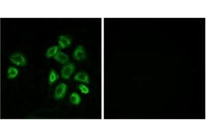 Immunofluorescence analysis of MCF7 cells, using GPRC5B Antibody. (GPRC5B antibody  (AA 61-110))