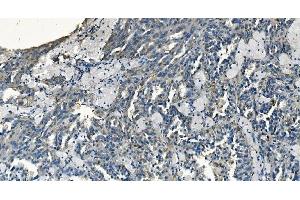 IHC analysis of GABARAP using anti-GABARAP antibody (ABIN7603159). (GABARAP antibody  (N-Term))