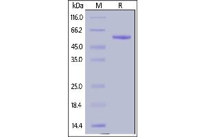 Human Complement Factor D, Fc Tag on  under reducing (R) condition.