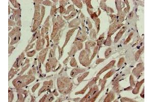 Immunohistochemistry of paraffin-embedded human heart tissue using ABIN7164781 at dilution of 1:100 (P4HA1 antibody  (AA 256-525))